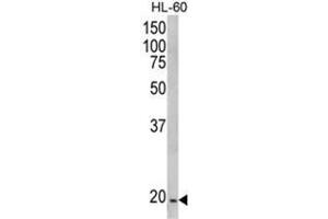 Western blot analysis of NDUFS4 Antibody (C-term) in HL-60 cell line lysates (35ug/lane).