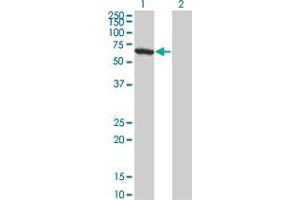Western Blot analysis of WDR20 expression in transfected 293T cell line by WDR20 monoclonal antibody (M01), clone 1D10. (WDR20 antibody  (AA 1-569))