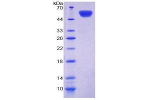 SDS-PAGE (SDS) image for Cadherin 11 (CDH11) (AA 374-595) protein (His tag,GST tag) (ABIN1980898) (OB Cadherin Protein (AA 374-595) (His tag,GST tag))