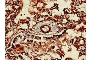 Immunohistochemistry of paraffin-embedded human lung tissue using ABIN7147067 at dilution of 1:100 (Caveolin 2 antibody  (AA 3-64))