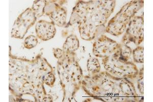Immunoperoxidase of monoclonal antibody to CHEK2 on formalin-fixed paraffin-embedded human placenta. (CHEK2 antibody  (AA 1-543))