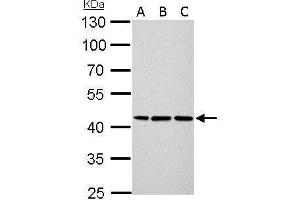 WB Image Cytokeratin 14 antibody detects KRT14 protein by Western blot analysis. (KRT14 antibody)