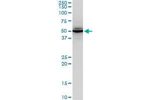 ABHD5 polyclonal antibody (A02), Lot # 060103JC01. (ABHD5 antibody  (AA 240-342))