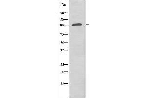 Western blot analysis of extracts from COLO205 cells, using ST5 antibody.