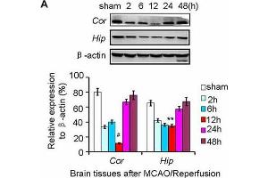 Nurr1 expression at 2, 6, 12, 24 and 48 h after MCAO/R.