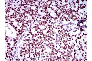 Immunohistochemistry (IHC) image for anti-Ring Finger Protein 1 (RING1) (AA 79-263) antibody (ABIN1724839)