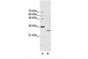Image no. 1 for anti-ATPase, Cu++ Transporting, alpha Polypeptide (ATP7A) (C-Term) antibody (ABIN203040) (ATP7A antibody  (C-Term))