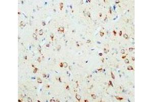 Immunohistochemical analysis of paraffin-embedded rat brain sections, stain NGF in cytoplasm DAB chromogenic reaction.