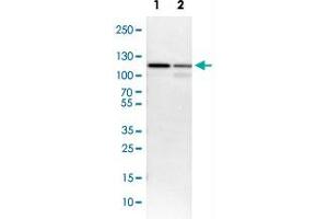 Western Blot analysis of Lane 1: NIH-3T3 cell lysate (mouse embryonic fibroblast cells) and Lane 2: NBT-II cell lysate (Wistar rat bladder tumor cells) with USP5 polyclonal antibody .