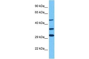 Host:  Rabbit  Target Name:  GLIS3  Sample Tissue:  Human 293T Whole Cell  Antibody Dilution:  1ug/ml (GLIS3 antibody  (C-Term))