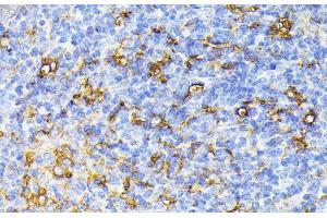 Immunohistochemistry of paraffin-embedded Mouse spleen using VEGF Receptor 1 Polyclonal Antibody at dilution of 1:100 (40x lens). (FLT1 antibody)