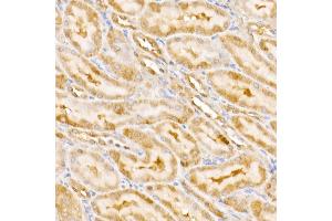 Immunohistochemistry of paraffin-embedded rat kidney using GPS1 Rabbit pAb (ABIN6127934, ABIN6141361, ABIN6141362 and ABIN6222653) at dilution of 1:250 (40x lens). (GPS1 antibody  (AA 258-527))