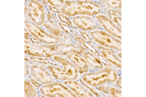 GPS1 antibody  (AA 258-527)