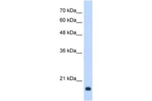 Western Blotting (WB) image for anti-Growth Arrest and DNA-Damage-Inducible, beta (GADD45B) antibody (ABIN2463174) (GADD45B antibody)