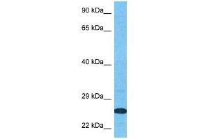 Host:  Rabbit  Target Name:  SPIT2  Sample Type:  MCF7 Whole Cell lysates  Antibody Dilution:  1. (SPIT2 antibody  (Middle Region))