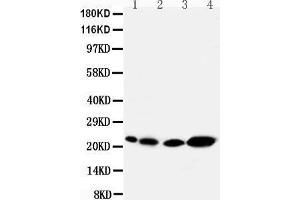 Anti-Caveolin-2 antibody, Western blotting Lane 1: Rat Heart Tissue Lysate Lane 2: Rat lung Tissue Lysate Lane 3: HELA Cell Lysate Lane 4: A431 Cell Lysate