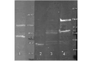 biotin conjugated anti adenosine deaminase  was used to detect adenosine deaminase in mouse pancreas lysate (Left, Lane 1, 30 ul) under reducing conditions. (ADA antibody  (Biotin))