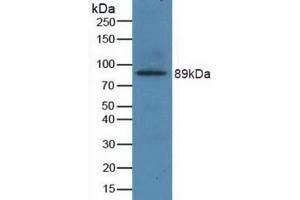 Detection of Recombinant GRIN2B, Human using Polyclonal Antibody to Glutamate Receptor, Ionotropic, N-Methyl-D-Aspartate 2B (GRIN2B) (GRIN2B antibody  (AA 35-557))
