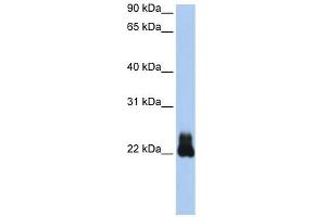 RHOD antibody used at 1 ug/ml to detect target protein. (RHOD antibody  (N-Term))