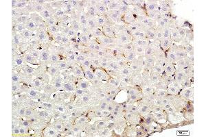 Formalin-fixed and paraffin embedded rat liver labeled with Anti-CD209 Polyclonal Antibody, Unconjugated (ABIN678893) at 1:200 followed by conjugation to the secondary antibody and DAB staining (DC-SIGN/CD209 antibody  (AA 81-180))