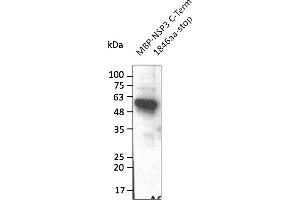 Western Blotting (WB) image for anti-SARS-CoV-2 Papain-Like Protease (NSP3) (C-Term) antibody (ABIN7272998) (SARS-CoV-2 NSP3 antibody  (C-Term))
