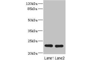 RAB17 抗体  (AA 1-212)