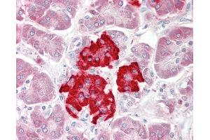 Human Pancreas: Formalin-Fixed, Paraffin-Embedded (FFPE). (DUSP4 antibody  (AA 325-374))