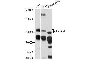 Western blot analysis of extracts of various cell lines, using TNPO1 antibody (ABIN6294176) at 1:1000 dilution.