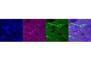 Immunohistochemistry (IHC) image for anti-Ubiquitin Carboxyl-terminal Esterase L1 (Ubiquitin Thiolesterase) (UCHL1) antibody (ABIN7456137) (UCHL1 antibody)