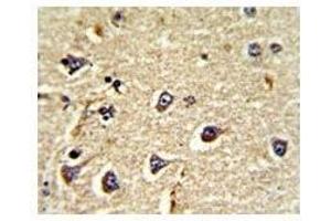 IHC analysis of FFPE human brain tissue stained with CD166 antibody