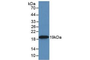 Detection of Recombinant HSPb6, Rat using Monoclonal Antibody to Heat Shock Protein Beta 6 (HSPb6) (HSPB6 antibody  (AA 1-162))