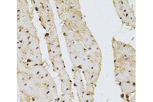 Immunohistochemistry of paraffin-embedded Rat heart using PPP2R5C Polyclonal Antibody at dilution of 1:100 (40x lens). (PPP2R5C antibody)