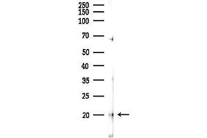 anti-Myosin Light Chain, phosphorylatable, Fast Skeletal Muscle (MYLPF) (C-Term) antibody
