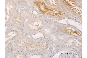 Immunoperoxidase of monoclonal antibody to S100A5 on formalin-fixed paraffin-embedded human kidney. (S100A5 antibody  (AA 1-90))