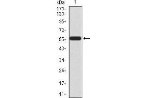 Western blot analysis using HOXA9 mAb against human HOXA9 (AA: 1-272) recombinant protein. (HOXA9 antibody  (AA 1-272))