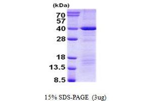 Image no. 1 for Death Effector Domain Containing (DEDD) protein (His tag) (ABIN7280134)