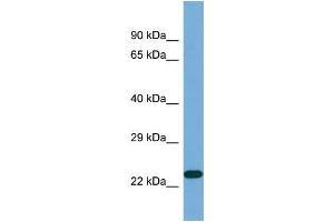 Western Blotting (WB) image for anti-Kallikrein 7 (KLK7) (Middle Region) antibody (ABIN2787364) (Kallikrein 7 antibody  (Middle Region))
