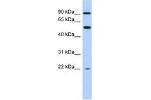 Image no. 1 for anti-Nuclear Receptor Subfamily 1, Group D, Member 2 (NR1D2) (AA 503-552) antibody (ABIN6742402) (NR1D2 antibody  (AA 503-552))