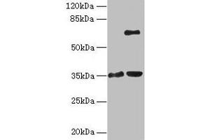 Western blot All lanes: ZNF75A antibody at 10 μg/mL Lane 1: Mouse brain tissue Lane 2: Mouse liver tissue Secondary Goat polyclonal to rabbit IgG at 1/10000 dilution Predicted band size: 35 kDa Observed band size: 35, 65 kDa (ZNF75A antibody  (AA 1-296))