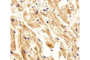 IHC analysis of FFPE human heart section using Integrin beta 8 antibody; Ab was diluted at 1:25. (ITGB8 antibody  (AA 197-231))