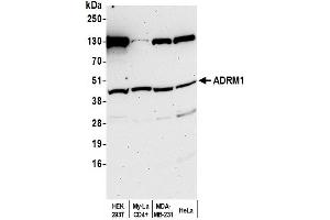 Western Blotting (WB) image for anti-Adhesion Regulating Molecule 1 (Adrm1) (AA 357-407) antibody (ABIN7449390)