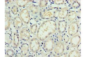 Immunohistochemistry of paraffin-embedded human kidney tissue using ABIN7171561 at dilution of 1:100 (TAF1C antibody  (AA 70-320))