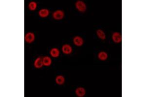 ABIN6274693 staining K562 by IF/ICC. (MLH3 antibody  (Internal Region))
