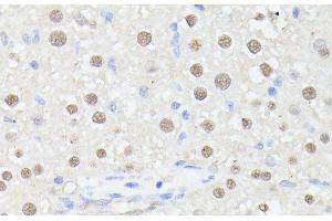 Immunohistochemistry of paraffin-embedded Rat liver using MLF2 Polyclonal Antibody at dilution of 1:100 (40x lens). (MLF2 antibody)