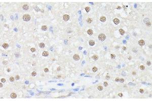 Immunohistochemistry of paraffin-embedded Rat liver using MLF2 Polyclonal Antibody at dilution of 1:100 (40x lens). (MLF2 antibody)