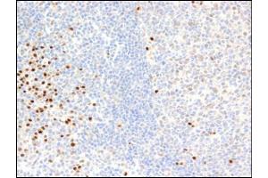 Immunohistochemistry using PIM2 mAb. (PIM2 antibody)