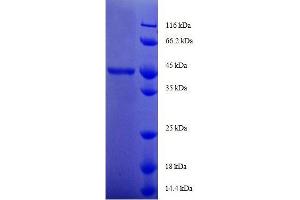 GM2 Ganglioside Activator (GM2A) (AA 32-193), (full length) protein (GST tag)