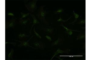 Immunofluorescence of monoclonal antibody to GCHFR on HeLa cell. (GCHFR antibody  (AA 1-84))