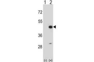 Western Blotting (WB) image for anti-Creatine Kinase, Mitochondrial 2 (Sarcomeric) (CKMT2) antibody (ABIN3002971) (CKMT2 antibody)