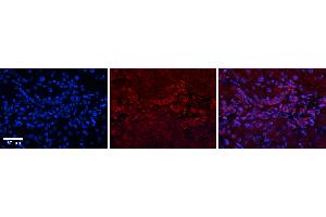 Rabbit Anti-GPD1 Antibody   Formalin Fixed Paraffin Embedded Tissue: Human Liver Tissue Observed Staining: Cytoplasm in bile ductule Primary Antibody Concentration: 1:100 Other Working Concentrations: N/A Secondary Antibody: Donkey anti-Rabbit-Cy3 Secondary Antibody Concentration: 1:200 Magnification: 20X Exposure Time: 0. (GPD1 antibody  (N-Term))